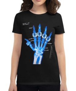 Nba Kobe Bryant Championship Broken Not Beaten T-shirt